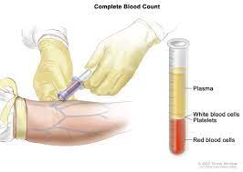 It can assist in diagnosing cancers, leukemia, anemia, and. Definition Of Complete Blood Count Nci Dictionary Of Cancer Terms National Cancer Institute