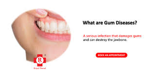 what are natural ways to treat gum