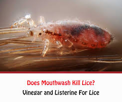mouthwash kill lice