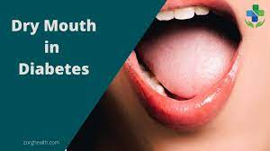 how to manage dry mouth in diabetes