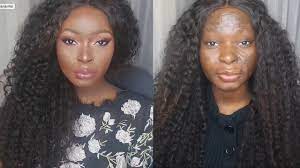 this burn survivor and makeup artist