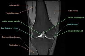 General anatomy and musculoskeletal system. Knee Imaging Knee Sports Orthobullets