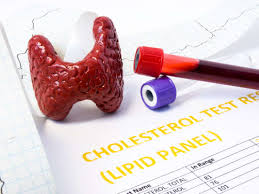 Thyroid Problems And Cholesterol Whats The Link