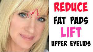 eye lift without surgery how to lift