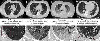 Heart And Lung Multimodality Imaging In