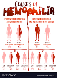 Hemophilia Causes Poster