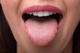 sore tongue 13 possible causes and