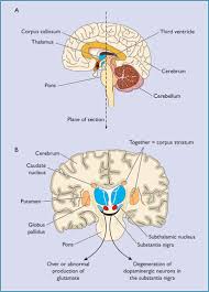 understanding patients with parkinson s