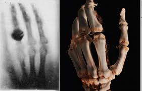 Check spelling or type a new query. X Ray Has Come A Long Way In 100 Years Imaging Technology News