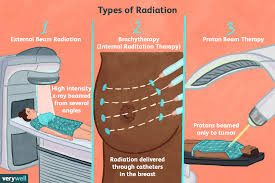 radiation therapy for t cancer