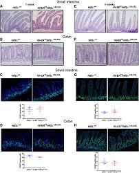 Small intestine vs large intestine and learn about all the similarities and differences between small and large intestine in detail. Temporal Induction Of Intestinal Epithelial Hypoxia Inducible Factor 2a Is Sufficient To Drive Colitis American Journal Of Physiology Gastrointestinal And Liver Physiology