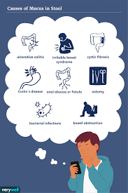 mucus in stool causes and when to be