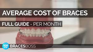Check spelling or type a new query. Average Cost Of Braces Per Month Full Pro Guide 2021 Bracesboss