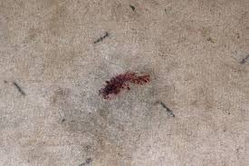 Sind die blutflecken noch frisch und nicht eingetrocknet, kannst du sie am einfachsten entfernen. Blutflecken Teppichboden Hausmittel Tipps Frag Mutti