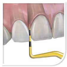 Periodontal Charting Profitable Or Not Hu Friedy