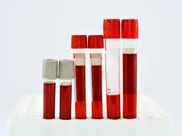 Complete Blood Count Cbc Types Preparation Procedure