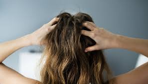 scalp contact dermais symptoms