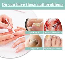 care pen cosmetic nail fungus treatment
