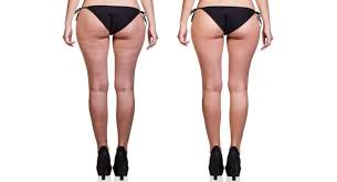 step by step guide to hide cellulite