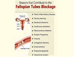 Check spelling or type a new query. How To Get Pregnant With One Fallopian Tube Conceiveeasy Com