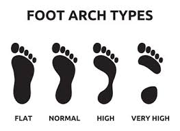 What Type Of Foot Arch Have You Got If Youre Not Sure