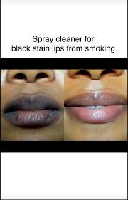 lip lightening balm spray black stain