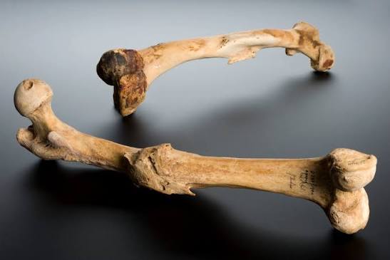File:Human left femur, Tell Fara, Palestine, 100 BCE-200 CE Wellcome L0057387.jpg - Wikimedia Commons