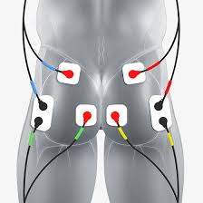 Glutes Electrode Pad Placement Compex Electrode Placement