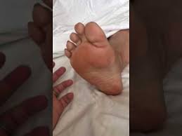 Foot Pain Plantar Fasciitis Reflexology Peace Of Mind Spa Inc