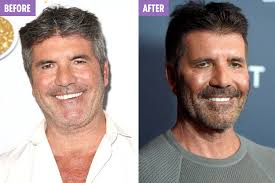 It's the #agt finals tonight. Simon Cowell Shows Off His Incredible 20lb Weight Loss On America S Got Talent Red Carpet
