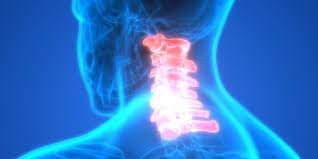 cervical herniated disc treatment