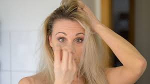 unusual menopause symptoms hair loss