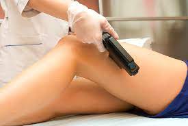 laser hair removal in canada
