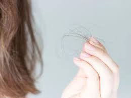reduce postpartum hair loss