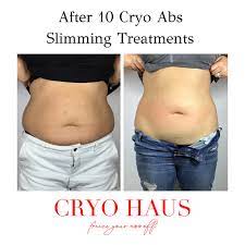 cryo slimming non invasive body
