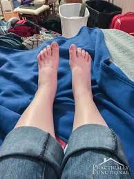 swollen feet during pregnancy