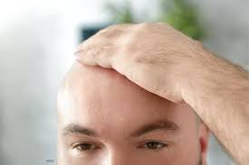 skin cancer removal on my head