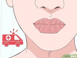 simple ways to heal a lip burn 9 steps