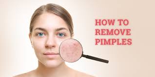 remove pimples and pimple marks