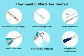 what are warts