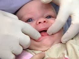 mom s kiss can spread cavities to baby