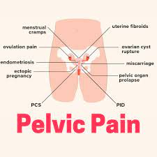 pelvic pain inspira physical therapy