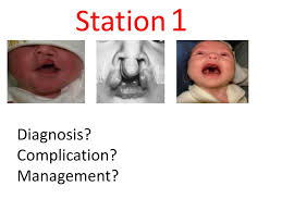 diagnosis complication management
