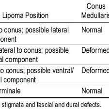 definition of sl by ncsl type