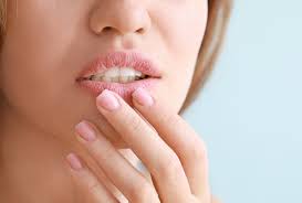 causes of chapped lips treatment options