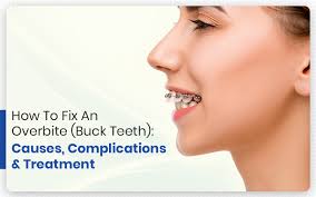 How to fix an overbite naturally at home. How To Fix An Overbite Buck Teeth Causes Complications Treatment