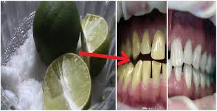 Cara memutihkan gigi secara alami dengan jeruk nipis tidak sulit. Cara Memutihkan Gigi Secara Alami Dengan Jeruk Nipis Dan Garam Berikut Ini Langkah Langkahnya Ini Cara Qu