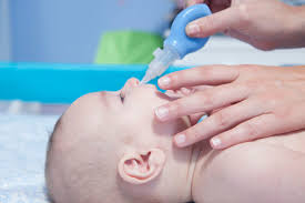 baby congestion 5 common causes and