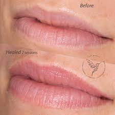 best lips permanent makeup montreal