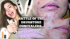 the best acne coverage concealer in the